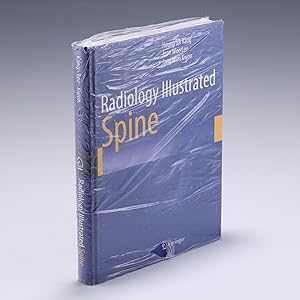 Seller image for Radiology Illustrated: Spine for sale by Salish Sea Books