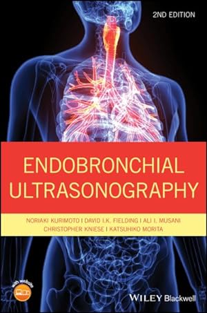 Seller image for Endobronchial Ultrasonography for sale by GreatBookPricesUK