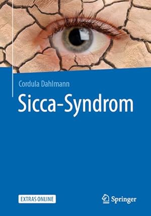 Seller image for Sicca-Syndrom for sale by Rheinberg-Buch Andreas Meier eK