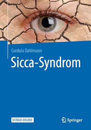 Seller image for Sicca-Syndrom for sale by BuchWeltWeit Ludwig Meier e.K.