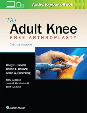 Bild des Verkufers fr Adult Knee : Knee Arthroplasty zum Verkauf von GreatBookPrices