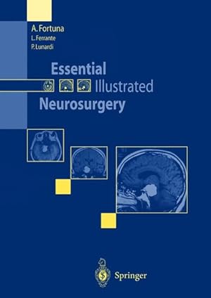 Essential Illustrated Neurosurgery.