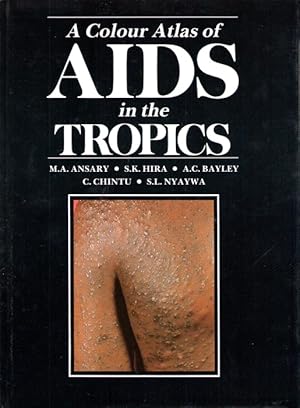 A Colour Atlas of Aids in the Tropics