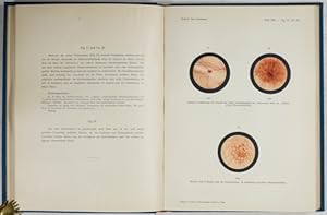 Die Cystoskopie im Dienste der Chirurgie. Ein Atlas mit cystoskopischen Bilder mit begleitendem T...