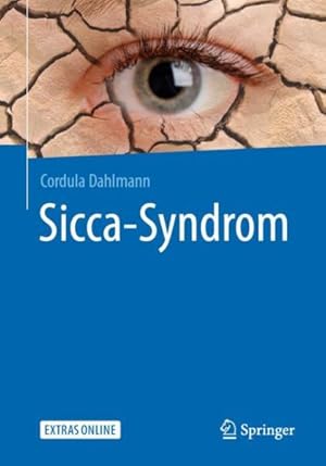 Seller image for Sicca-syndrom -Language: german for sale by GreatBookPricesUK