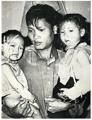 Guerre du Vietnam, enfants blessés près d'Hanoi, décembre 1966