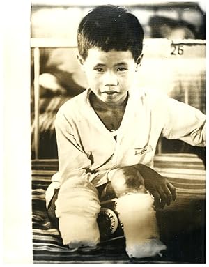 Vietnam, petit garçon à l'hôpital de Cho Ray à Saigon, février 1968