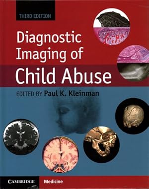 Imagen del vendedor de Diagnostic Imaging of Child Abuse a la venta por GreatBookPricesUK