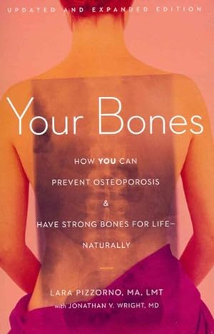 Immagine del venditore per Your Bones : How You Can Prevent Osteoporosis & Have Strong Bones for Life - Naturally venduto da GreatBookPricesUK