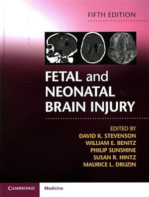 Seller image for Fetal and Neonatal Brain Injury for sale by GreatBookPricesUK