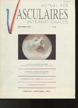 Bild des Verkufers fr Actualits vasculaires internationales- N36 - Dcembre 1995-Sommaire: L'angioplastie des carotides: le point de vue du chirurgien vasculaire- Syndrome d'apnes du sommeil et hypertension artrielle- Anesthsie dans la chirurgie des varices- La riartrite zum Verkauf von Le-Livre