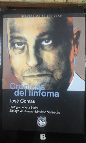 Imagen del vendedor de José Comas: CRONICAS DEL LINFOMA (Madrid, 2009) a la venta por Multilibro