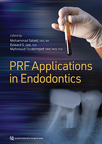 Seller image for PRF Applications in Endodontics for sale by Vuestros Libros