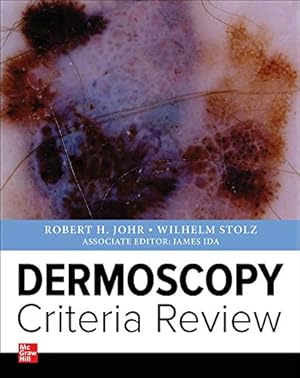 Imagen del vendedor de Dermoscopy Criteria Review by Johr, Robert, Stolz, Wilhelm [Paperback ] a la venta por booksXpress