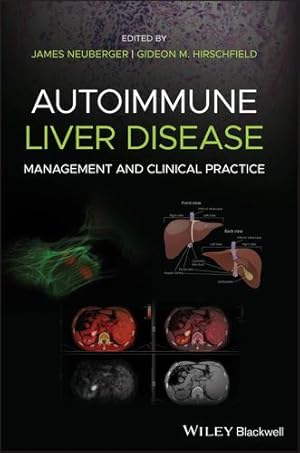 Bild des Verkufers fr Autoimmune Liver Disease: Management and Clinical Practice [Hardcover ] zum Verkauf von booksXpress