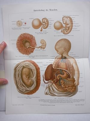 Antique Meyers Lexikon chromolighograph of ENTWICKELUNG DES MENSCHEN (1890)