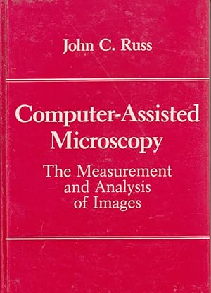 Bild des Verkufers fr Computer-Assisted Microscopy: The Measurement and Analysis of Images zum Verkauf von Robinson Street Books, IOBA