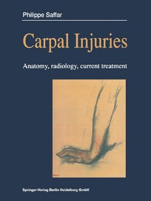 Seller image for Carpal injuries: Anatomy, radiology, current treatment by Saffar, Philippe [FRENCH LANGUAGE - Paperback ] for sale by booksXpress