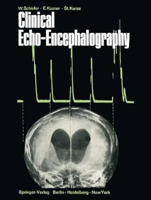 Bild des Verkufers fr Clinical Echo-Encephalography by Schiefer, Wolfgang, Kazner, Ekkehard, Kunze, Stefan [Paperback ] zum Verkauf von booksXpress