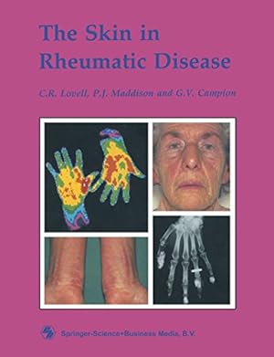 Immagine del venditore per The Skin in Rheumatic Disease by Lovell, C. R., Campion, G. V., Maddison, P. J. [Paperback ] venduto da booksXpress