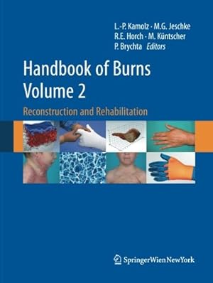 Image du vendeur pour Handbook of Burns Volume 2: Reconstruction and Rehabilitation [Paperback ] mis en vente par booksXpress