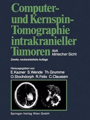 Bild des Verkufers fr Computer- und Kernspin-Tomographie intrakranieller Tumoren aus klinischer Sicht (German Edition) [Paperback ] zum Verkauf von booksXpress