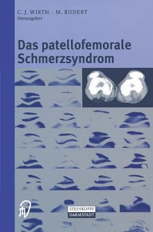 Seller image for Das patellofemorale Schmerzsyndrom (German Edition) [Paperback ] for sale by booksXpress