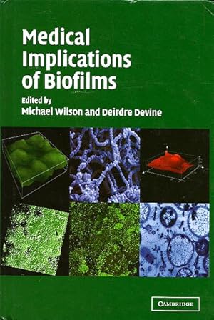 Medical Implications of Biofilms