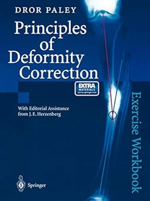 Imagen del vendedor de Principles of Deformity Correction [Soft Cover ] a la venta por booksXpress