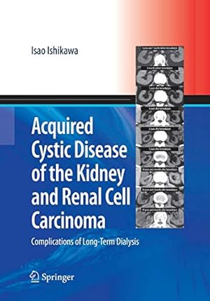 Image du vendeur pour Acquired Cystic Disease of the Kidney and Renal Cell Carcinoma: Complication of Long-Term Dialysis [Soft Cover ] mis en vente par booksXpress