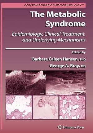 Seller image for The Metabolic Syndrome:: Epidemiology, Clinical Treatment, and Underlying Mechanisms (Contemporary Endocrinology) [Paperback ] for sale by booksXpress