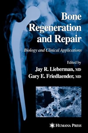 Image du vendeur pour Bone Regeneration and Repair: Biology and Clinical Applications [Hardcover ] mis en vente par booksXpress