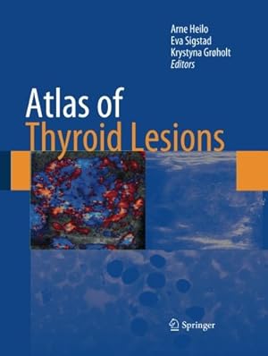 Immagine del venditore per Atlas of Thyroid Lesions [Paperback ] venduto da booksXpress