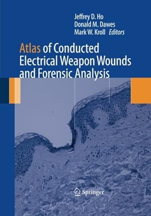 Bild des Verkufers fr Atlas of Conducted Electrical Weapon Wounds and Forensic Analysis [Paperback ] zum Verkauf von booksXpress