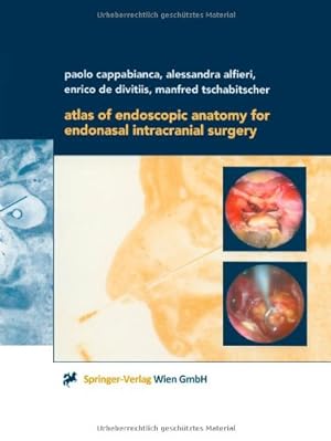 Seller image for Atlas of Endoscopic Anatomy for Endonasal Intracranial Surgery by Cappabianca, Paolo [Paperback ] for sale by booksXpress