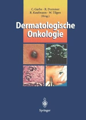 Seller image for Dermatologische Onkologie (German Edition) [Paperback ] for sale by booksXpress