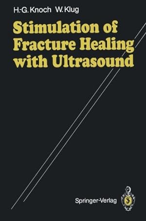 Seller image for Stimulation of Fracture Healing with Ultrasound by Knoch, Hans-Georg, Klug, Winfried [Paperback ] for sale by booksXpress
