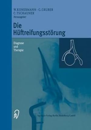 Immagine del venditore per Die Hüftreifungsstörung: Diagnose und Therapie (German Edition) [Paperback ] venduto da booksXpress