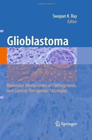 Immagine del venditore per Glioblastoma:: Molecular Mechanisms of Pathogenesis and Current Therapeutic Strategies [Hardcover ] venduto da booksXpress