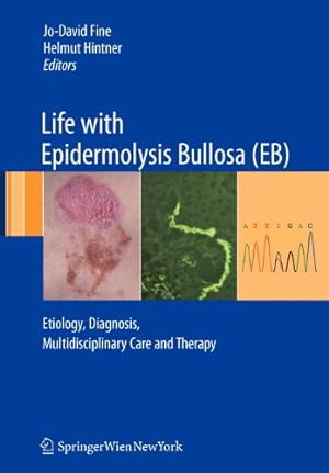Immagine del venditore per Life with Epidermolysis Bullosa (EB): Etiology, Diagnosis, Multidisciplinary Care and Therapy [Paperback ] venduto da booksXpress
