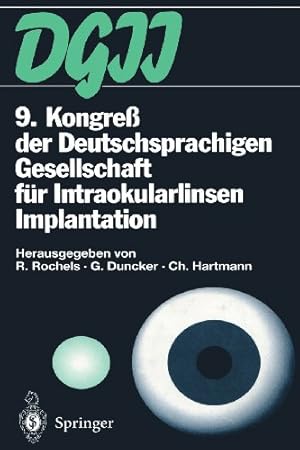 Seller image for 9. Kongre der Deutschsprachigen Gesellschaft für Intraokularlinsen Implantation: 17. bis 19. März 1995, Kiel (German Edition) [Paperback ] for sale by booksXpress