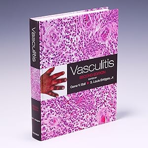 Seller image for Vasculitis for sale by Salish Sea Books