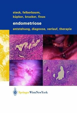 Image du vendeur pour Endometriose: Entstehung, Diagnose, Verlauf und Therapie (German Edition) by Steck, Thomas, Felberbaum, Ricardo E., Küpker, Wolfgang, Brucker, Cosima, Finas, Dominique F. [Paperback ] mis en vente par booksXpress