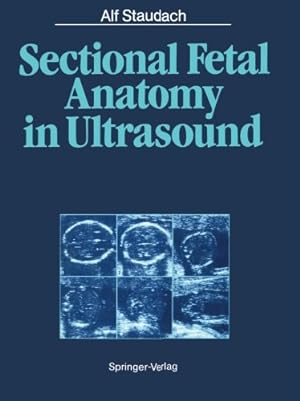 Imagen del vendedor de Sectional Fetal Anatomy in Ultrasound by Staudach, Alf [Paperback ] a la venta por booksXpress