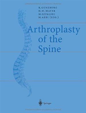 Bild des Verkufers fr Arthroplasty of the Spine (European Spine Journal, V. 11, Suppl. 2) [Paperback ] zum Verkauf von booksXpress