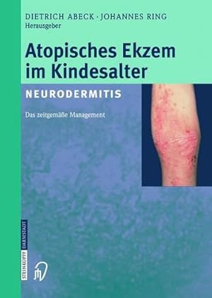 Immagine del venditore per Atopisches Ekzem im Kindesalter (Neurodermitis): Zeitgemä es Management (German Edition) [Paperback ] venduto da booksXpress