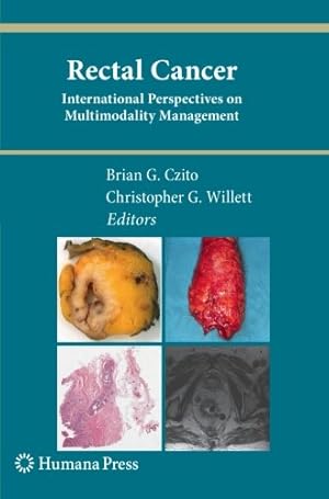Immagine del venditore per Rectal Cancer: International Perspectives on Multimodality Management (Current Clinical Oncology) [Paperback ] venduto da booksXpress
