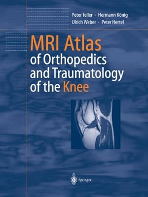 Seller image for MRI Atlas of Orthopedics and Traumatology of the Knee by Teller, Peter, König, Hermann, Weber, Ulrich, Hertel, Peter [Paperback ] for sale by booksXpress