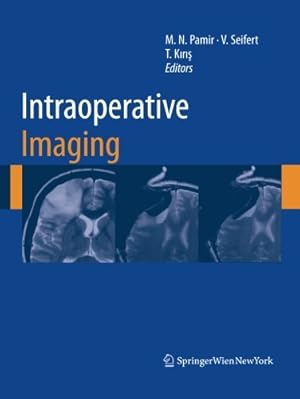 Seller image for Intraoperative Imaging (Acta Neurochirurgica Supplement) [Paperback ] for sale by booksXpress