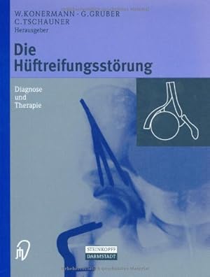 Immagine del venditore per Die Hüftreifungsstörung: Diagnose und Therapie (German Edition) [Hardcover ] venduto da booksXpress